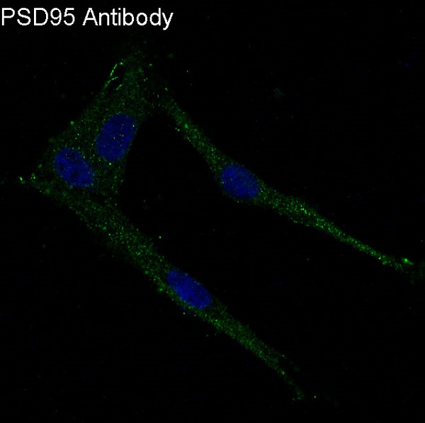 3 - Anti-PSD95 DLG4 Rabbit Monoclonal Antibody ABO13633
