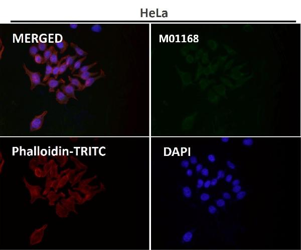 1 - Anti-VDAC1/Porin Rabbit Monoclonal Antibody ABO13634