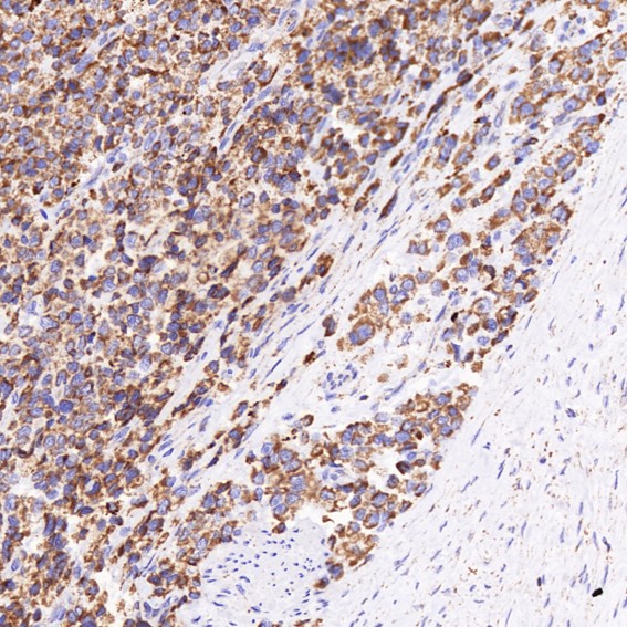 2 - Anti-VDAC1/Porin Rabbit Monoclonal Antibody ABO13634