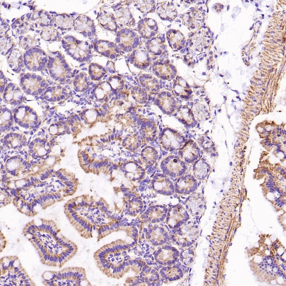 2 - Anti-VDAC1/Porin Rabbit Monoclonal Antibody ABO13634