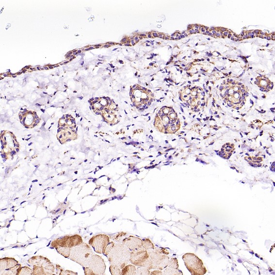 2 - Anti-VDAC1/Porin Rabbit Monoclonal Antibody ABO13634