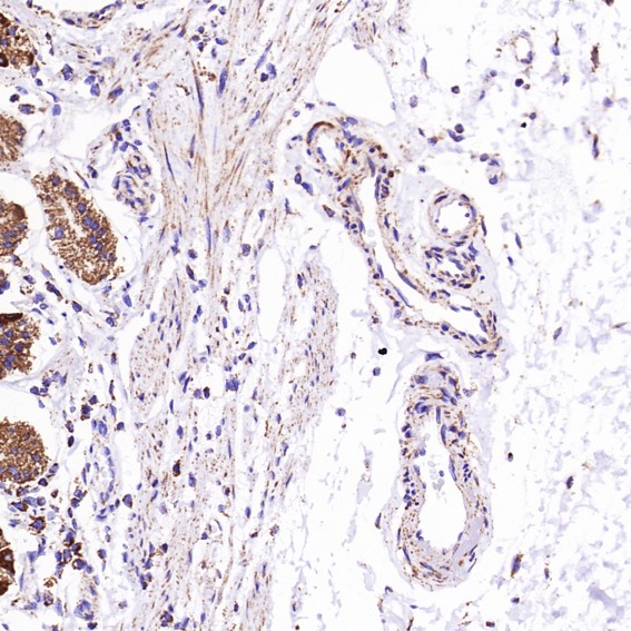 2 - Anti-VDAC1/Porin Rabbit Monoclonal Antibody ABO13634