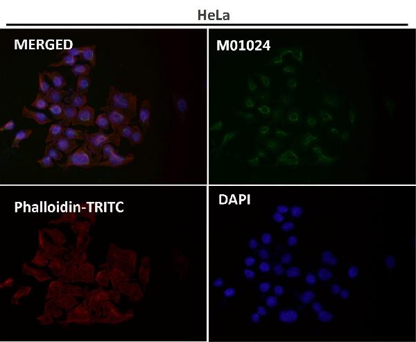 1 - Anti-Hsc70 HSPA8 Rabbit Monoclonal Antibody ABO13635