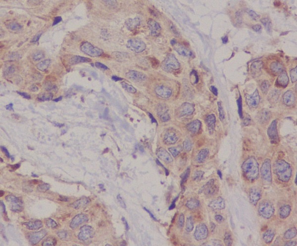 2 - Anti-Hsc70 HSPA8 Rabbit Monoclonal Antibody ABO13635