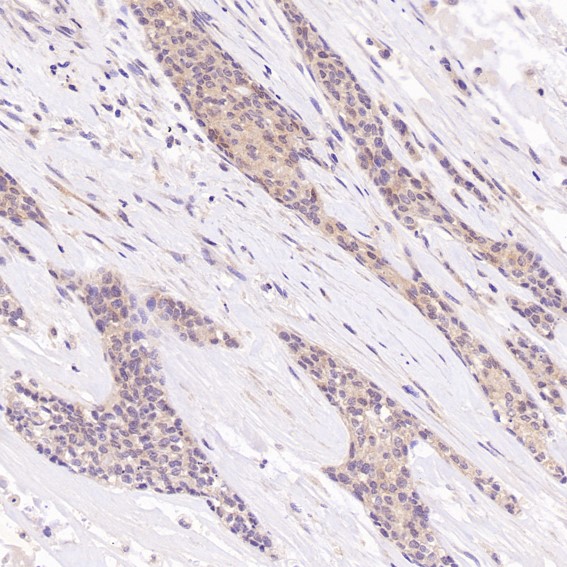 2 - Anti-Hsc70 HSPA8 Rabbit Monoclonal Antibody ABO13635
