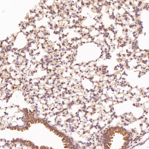 2 - Anti-Hsc70 HSPA8 Rabbit Monoclonal Antibody ABO13635