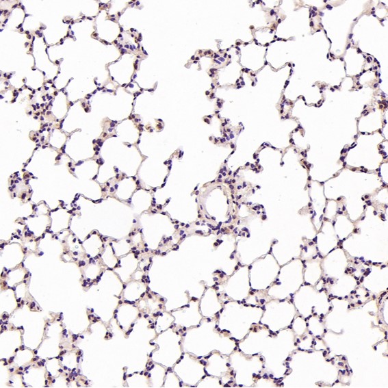 2 - Anti-Hsc70 HSPA8 Rabbit Monoclonal Antibody ABO13635