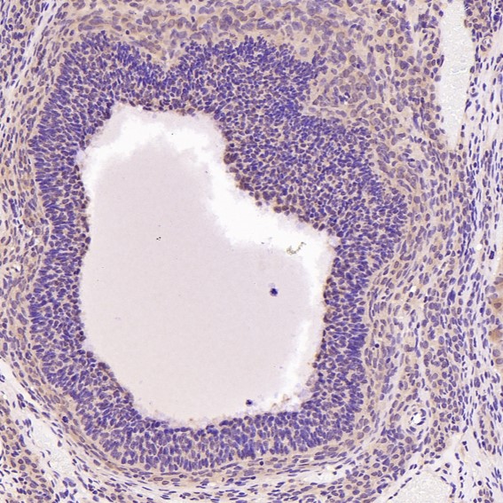 2 - Anti-Hsc70 HSPA8 Rabbit Monoclonal Antibody ABO13635