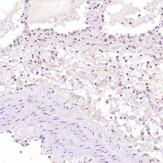 2 - Anti-Hsc70 HSPA8 Rabbit Monoclonal Antibody ABO13635