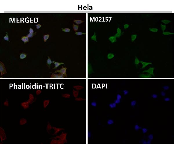 1 - Anti-DUSP6/Mkp 3 Rabbit Monoclonal Antibody ABO13636