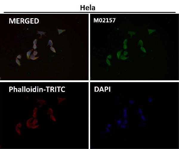 1 - Anti-DUSP6/Mkp 3 Rabbit Monoclonal Antibody ABO13636