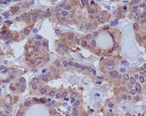 2 - Anti-DUSP6/Mkp 3 Rabbit Monoclonal Antibody ABO13636