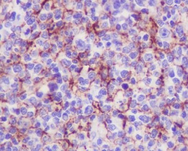 2 - Anti-VCAM1/Cd106 Rabbit Monoclonal Antibody ABO13637