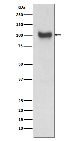 1 - Anti-VCAM1/Cd106 Rabbit Monoclonal Antibody ABO13637