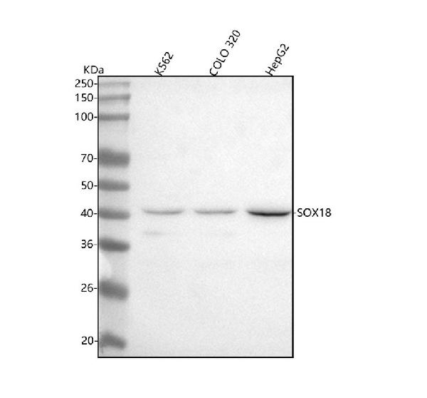1 - Anti-SOX18 Rabbit Monoclonal Antibody ABO13638