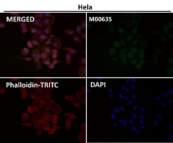 1 - Anti-PRMT5 Rabbit Monoclonal Antibody ABO13639