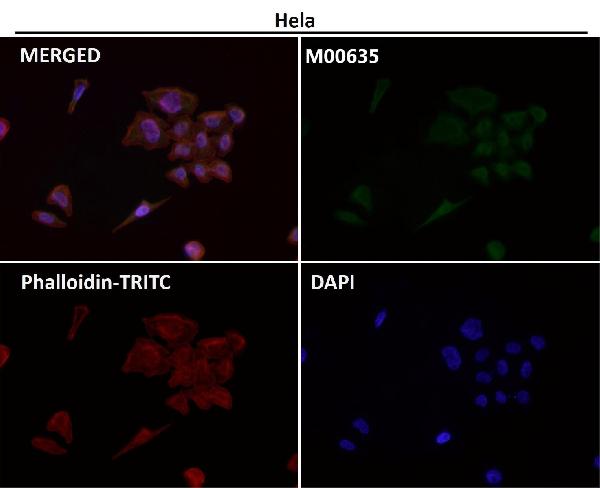 1 - Anti-PRMT5 Rabbit Monoclonal Antibody ABO13639