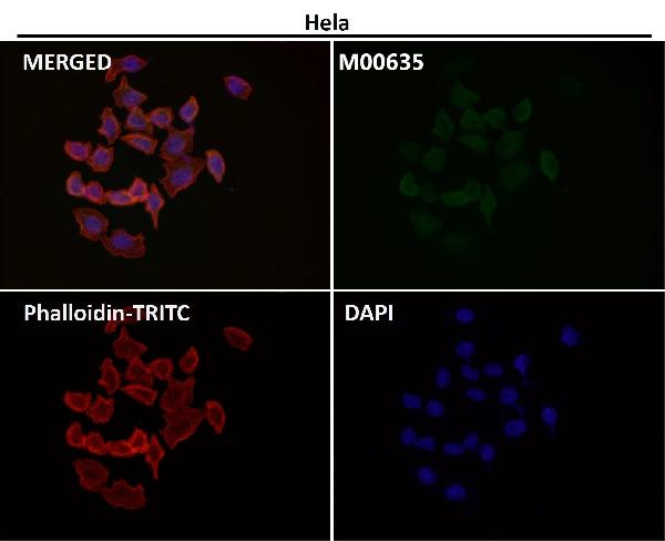 1 - Anti-PRMT5 Rabbit Monoclonal Antibody ABO13639