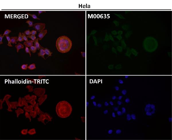 1 - Anti-PRMT5 Rabbit Monoclonal Antibody ABO13639