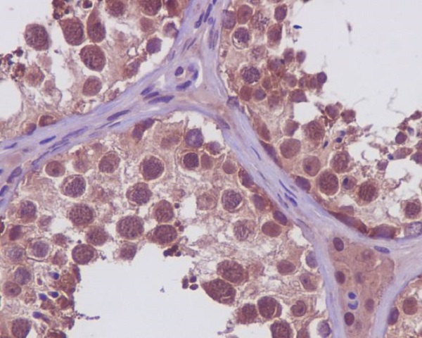 2 - Anti-PRMT5 Rabbit Monoclonal Antibody ABO13639