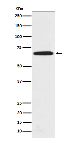 1 - Anti-PRMT5 Rabbit Monoclonal Antibody ABO13639