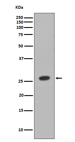 1 - Anti-HOXB9 Rabbit Monoclonal Antibody ABO13640