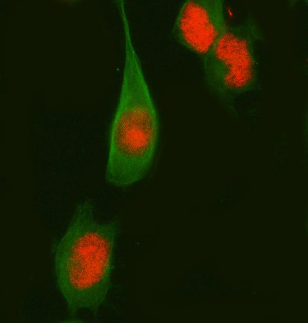 3 - Anti-Fos B Rabbit Monoclonal Antibody ABO13641
