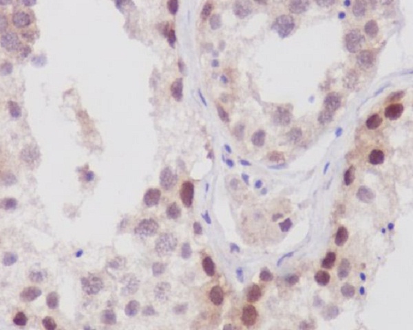 2 - Anti-NUP98 Rabbit Monoclonal Antibody ABO13642