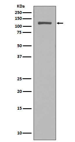1 - Anti-NUP98 Rabbit Monoclonal Antibody ABO13642