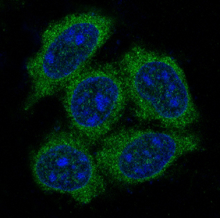 3 - Anti-Hsp70 HSPA1A Rabbit Monoclonal Antibody ABO13643