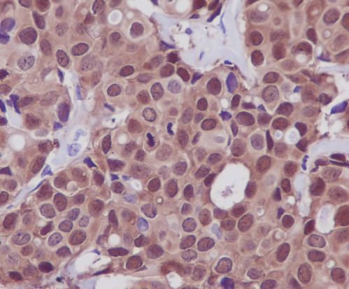 2 - Anti-Hsp70 HSPA1A Rabbit Monoclonal Antibody ABO13643