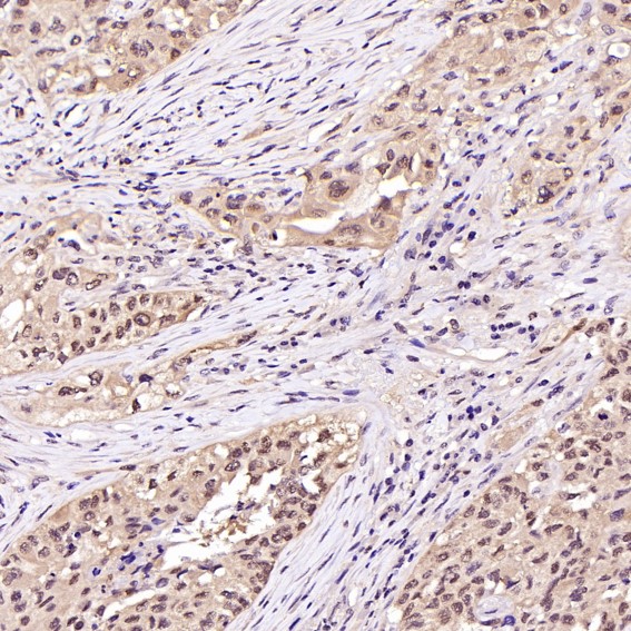 2 - Anti-Hsp70 HSPA1A Rabbit Monoclonal Antibody ABO13643