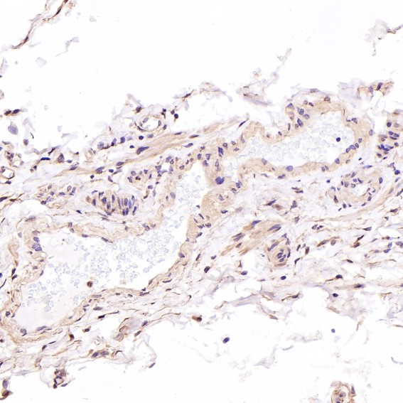 2 - Anti-Hsp70 HSPA1A Rabbit Monoclonal Antibody ABO13643