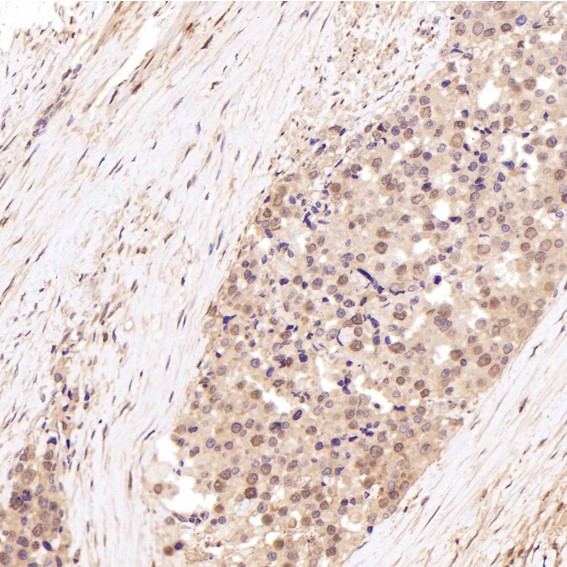 2 - Anti-Hsp70 HSPA1A Rabbit Monoclonal Antibody ABO13643