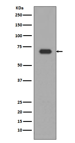 1 - Anti-Alas1/Alas H Rabbit Monoclonal Antibody ABO13645