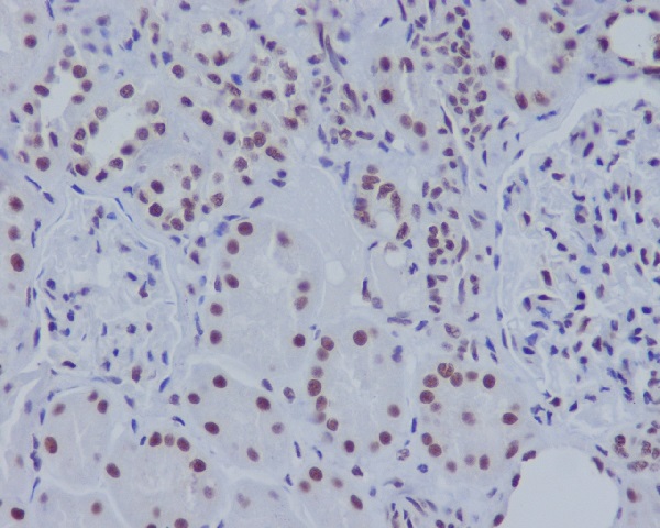 2 - Anti-ASH2L Rabbit Monoclonal Antibody ABO13646