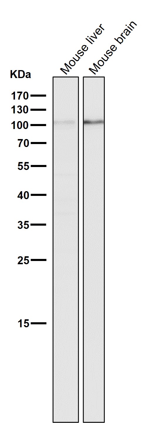1 - Anti-DGCR8 Rabbit Monoclonal Antibody ABO13647
