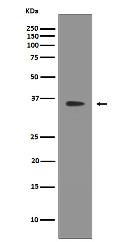 1 - Anti-SIRT2/Sirtuin 2 Rabbit Monoclonal Antibody ABO13648