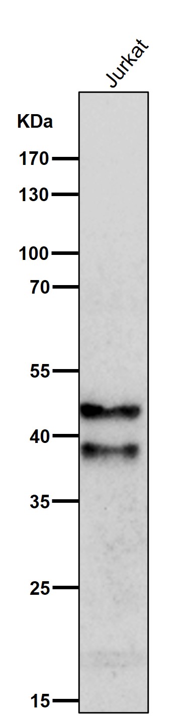 1 - Anti-SIRT2/Sirtuin 2 Rabbit Monoclonal Antibody ABO13648