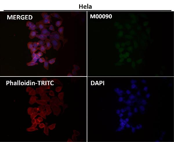 1 - Anti-Smad2 Rabbit Monoclonal Antibody ABO13650