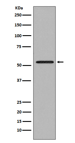 1 - Anti-Smad2 Rabbit Monoclonal Antibody ABO13650