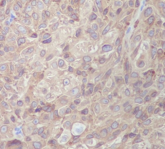 2 - Anti-MLANA/Mart 1 Rabbit Monoclonal Antibody ABO13653