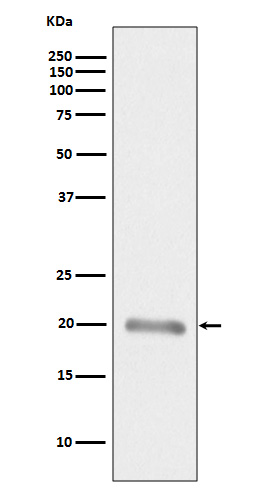 1 - Anti-MLANA/Mart 1 Rabbit Monoclonal Antibody ABO13653