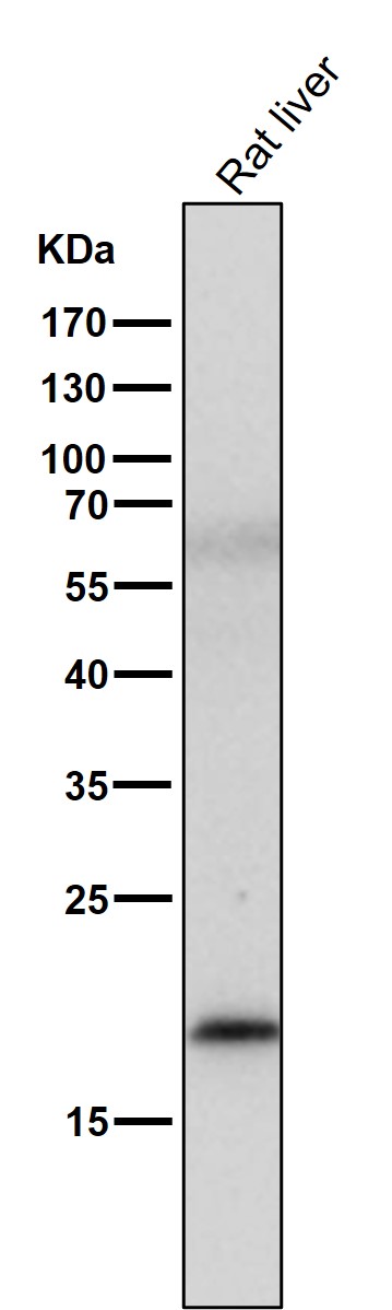 1 - Anti-MLANA/Mart 1 Rabbit Monoclonal Antibody ABO13653