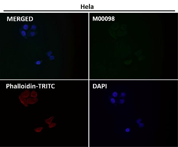 1 - Anti-FGFR1 Rabbit Monoclonal Antibody ABO13654