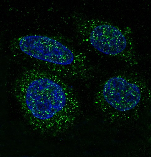 3 - Anti-FGFR1 Rabbit Monoclonal Antibody ABO13654