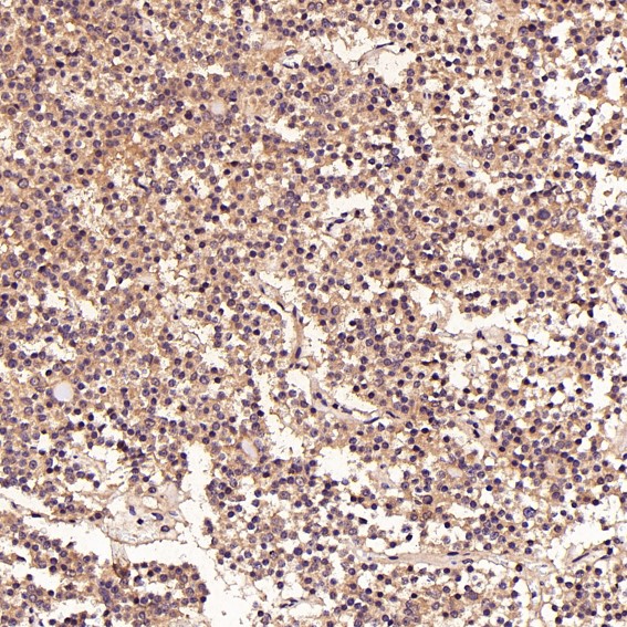 2 - Anti-FGFR1 Rabbit Monoclonal Antibody ABO13654