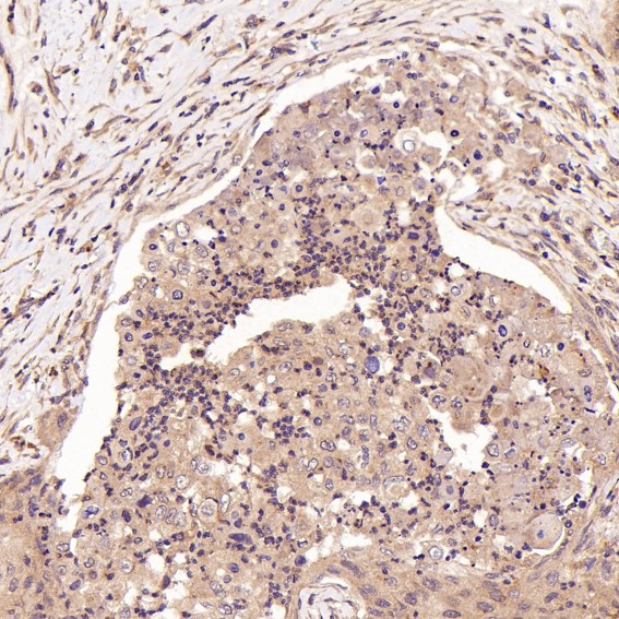 2 - Anti-FGFR1 Rabbit Monoclonal Antibody ABO13654