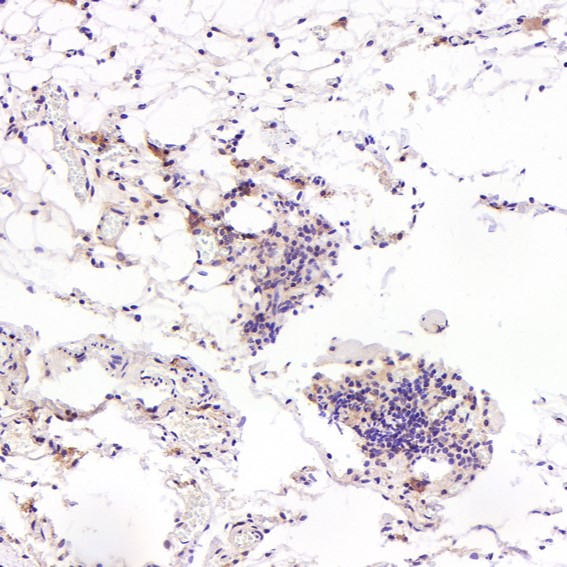 2 - Anti-FGFR1 Rabbit Monoclonal Antibody ABO13654