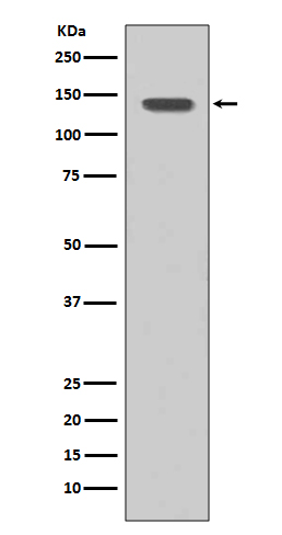 1 - Anti-FGFR1 Rabbit Monoclonal Antibody ABO13654